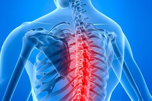 Coloana vertebrală toracală cu semne de osteocondroză