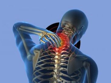 O persoană cu osteocondroză a coloanei cervicale este deranjată de dureri de gât