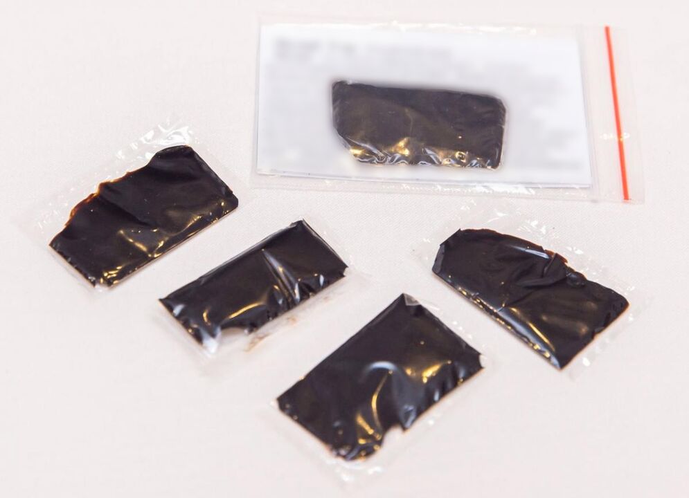 Shilajit este un remediu eficient pentru tratamentul osteocondrozei cervicale la domiciliu